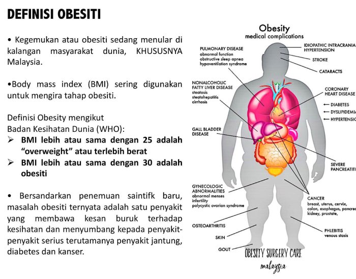 Sakit tanda saja gejalanya mellitus